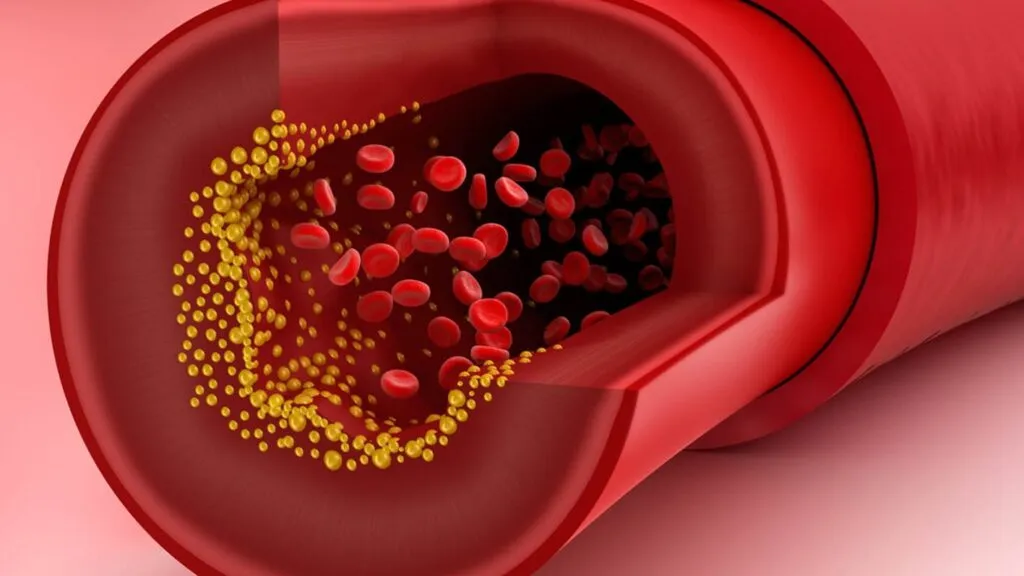 علاج الكوليسترول الضار في الدم بدون أدوية