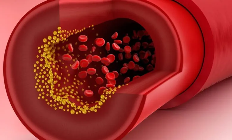 علاج الكوليسترول الضار في الدم بدون أدوية